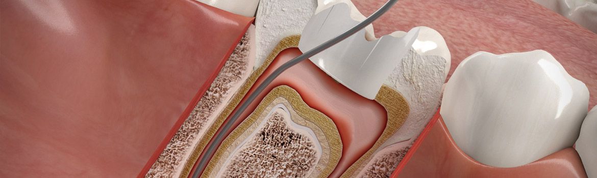 Endodontie